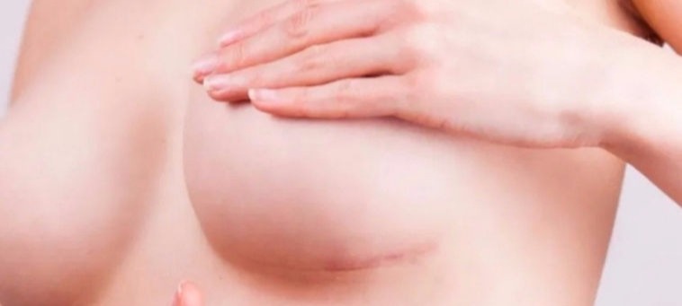  Especialista em Camuflagem de Cicatriz na Barra da Tijuca